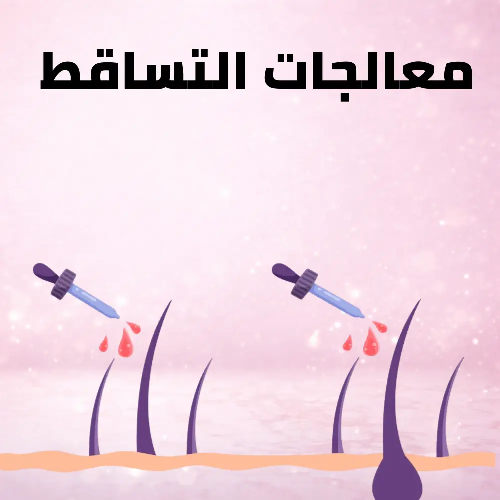 معالجات التساقط